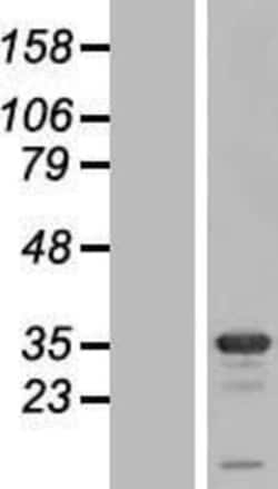 Novus Biologicals&trade;&nbsp;Syntaxin 1B Overexpression Lysate