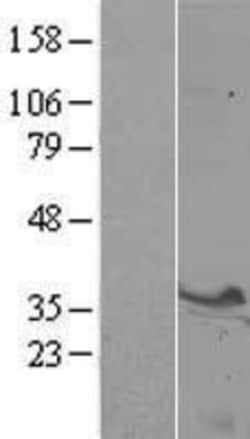 Novus Biologicals&trade;&nbsp;Syntaxin 3 Overexpression Lysate