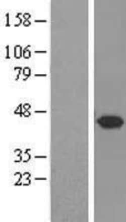 Novus Biologicals&trade;&nbsp;Syntaxin 5 Overexpression Lysate