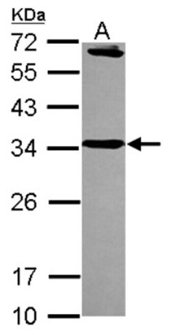 Syntaxin 6 Antibody, Novus Biologicals 0.1mL; Unlabeled:Antibodies, Polyclonal