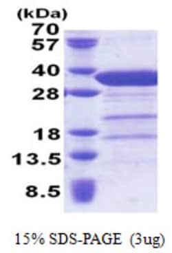Novus Biologicals&trade;&nbsp;Recombinant Human Syntaxin 6 His Protein