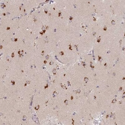 Syntaxin 16 Antibody, Novus Biologicals:Antibodies:Primary Antibodies