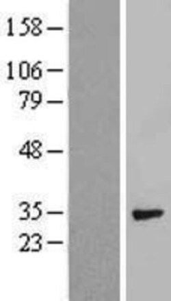 Novus Biologicals&trade;&nbsp;Syntenin 1 Overexpression Lysate