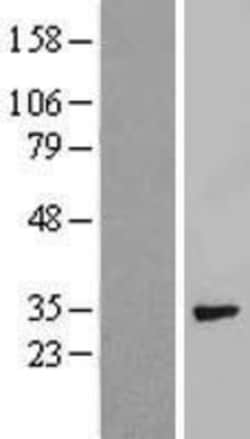 Novus Biologicals™ Syntenin 1 Overexpression Lysate
