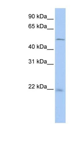 Syntenin 2 Antibody, Novus Biologicals:Antibodies:Primary Antibodies