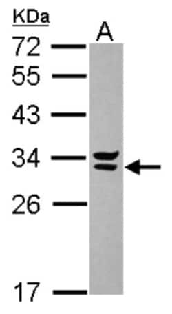 Syntenin 2 Antibody, Novus Biologicals 0.1mL; Unlabeled:Antibodies, Polyclonal