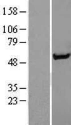 Novus Biologicals&trade;&nbsp;Syntrophin alpha 1 Overexpression Lysate