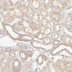 Syntrophin beta 1 Antibody, Novus Biologicals 25 &mu;L; Unlabeled:Antibodies,