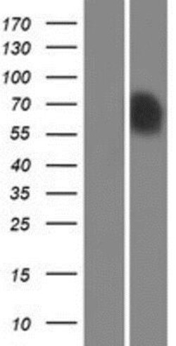Novus Biologicals&trade;&nbsp;Syntrophin beta 1 Overexpression Lysate