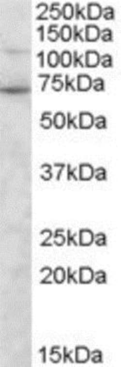 Syntrophin gamma 2 Antibody, Novus Biologicals 0.1mg; Unlabeled:Antibodies,