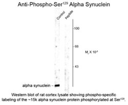 alpha-Synuclein, p Ser129 Antibody, Novus Biologicals 0.1mL; Unlabeled:Antibodies,