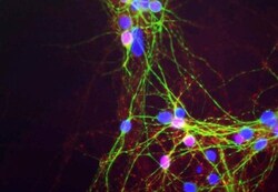 alpha-Synuclein Antibody (2A7), Novus Biologicals 0.1 mL; Unconjugated:Antibodies,