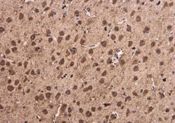 anti-Synuclein-alpha, Polyclonal, Novus Biologicals 0.1mL; Unlabeled:Antibodies,