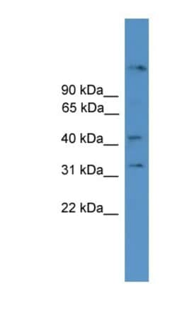 SYT11 Antibody, Novus Biologicals:Antibodies:Primary Antibodies