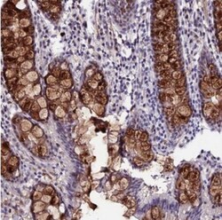 SYT15 Antibody, Novus Biologicals 25 &mu;L | Buy Online | Novus Biologicals | Fisher Scientific