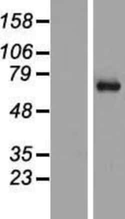 Novus Biologicals&trade;&nbsp;SYT16 Overexpression Lysate