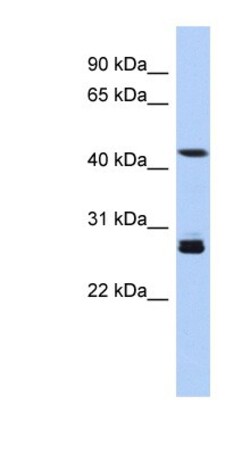 SYT9 Antibody, Novus Biologicals 20&mu;L; Unlabeled:Antibodies, Polyclonal