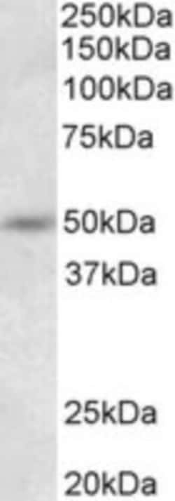 SYT9 Antibody, Novus Biologicals 0.1mg; Unlabeled:Antibodies, Polyclonal