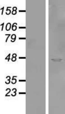 Novus Biologicals&trade;&nbsp;SYTL2 Overexpression Lysate
