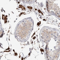 SYTL5 Antibody, Novus Biologicals 0.1 mL | Buy Online | Novus Biologicals | Fisher Scientific
