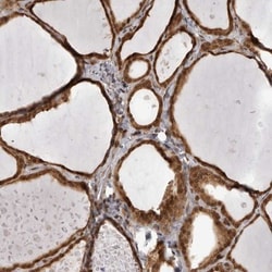SZRD1 Antibody, Novus Biologicals 25 &mu;L; Unlabeled:Antibodies, Polyclonal