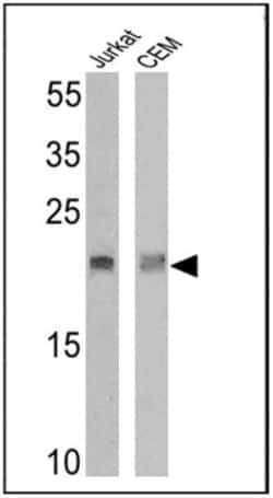 TCR V delta 2 Antibody (15D), Novus Biologicals 50 &mu;g, Unconjugated:Antibodies,