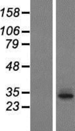 Novus Biologicals&trade;&nbsp;T2R60 Overexpression Lysate