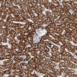 Myotubularin Antibody, Novus Biologicals:Antibodies:Primary Antibodies