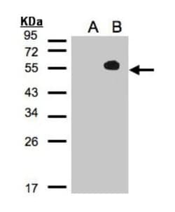 TAB1 Antibody, Novus Biologicals 0.1mL; Unlabeled:Antibodies, Polyclonal