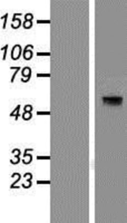 Novus Biologicals&trade;&nbsp;TAB1 Overexpression Lysate