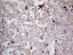 TACC2 Antibody (OTI3C4), Novus Biologicals 0.1mL; Unlabeled:Antibodies,