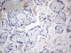 TACC2 Antibody (OTI3C4), Novus Biologicals 0.1mL; Unlabeled:Antibodies,
