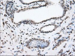 TACC3 Antibody (OTI6F1), Novus Biologicals 0.1mL; Unlabeled:Antibodies,