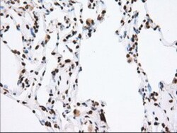TACC3 Antibody (OTI6F1), Novus Biologicals 0.1mL; Unlabeled:Antibodies,