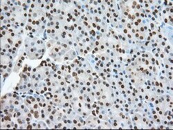 TACC3 Antibody (OTI6F1), Novus Biologicals 0.1mL; Unlabeled:Antibodies,