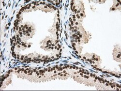 TACC3 Antibody (OTI6F1), Novus Biologicals 0.1mL; Unlabeled:Antibodies,