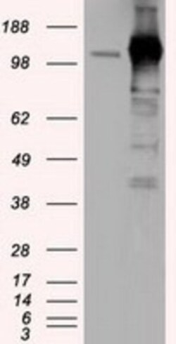TACC3 Antibody (OTI6F1), Novus Biologicals 0.1mL; Unlabeled:Antibodies,
