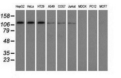 TACC3 Antibody (OTI6F1), Novus Biologicals 0.1mL; Unlabeled:Antibodies,