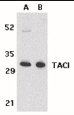 TACI/TNFRSF13B/CVID Antibody - BSA Free, Novus Biologicals 0.1mg; Unlabeled:Antibodies,
