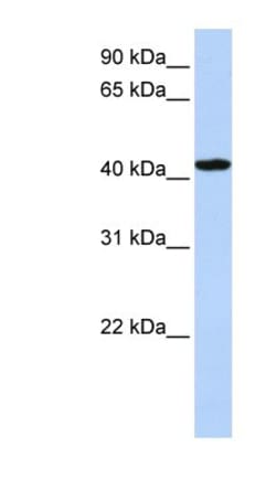TADA1L Antibody, Novus Biologicals:Antibodies:Primary Antibodies
