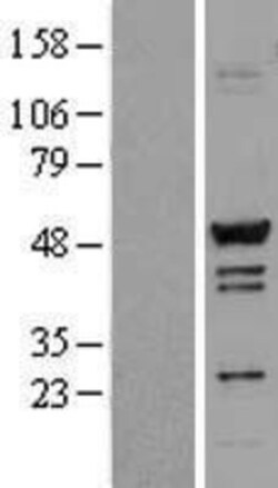 Novus Biologicals&trade;&nbsp;TADA3L Overexpression Lysate