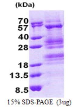Novus Biologicals&trade;&nbsp;Recombinant Human TADA3L His Protein