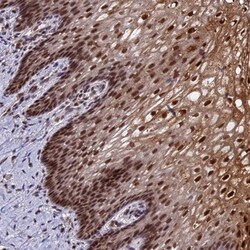 TADA3L Antibody, Novus Biologicals 25 &mu;L; Unlabeled:Antibodies, Polyclonal
