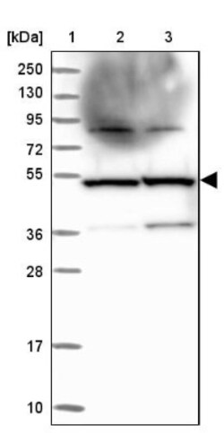 TADA3L Antibody, Novus Biologicals 25 &mu;L; Unlabeled:Antibodies, Polyclonal