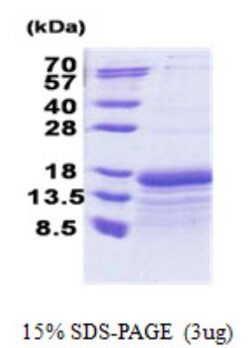 Novus Biologicals&trade;&nbsp;Recombinant Human TAF10 His Protein