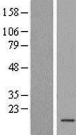 Novus Biologicals&trade;&nbsp;TAF13 Overexpression Lysate