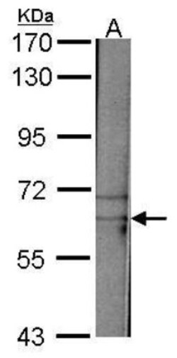 TAF15 Antibody, Novus Biologicals 0.1mg; Unlabeled:Antibodies, Polyclonal