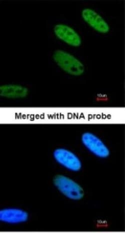 TAF15 Antibody, Novus Biologicals 0.1mg; Unlabeled:Antibodies, Polyclonal