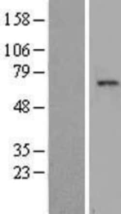 Novus Biologicals&trade;&nbsp;TAF1B Overexpression Lysate