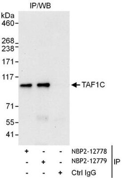 TAF1C Antibody, Novus Biologicals 0.1mg; Unlabeled:Antibodies, Polyclonal